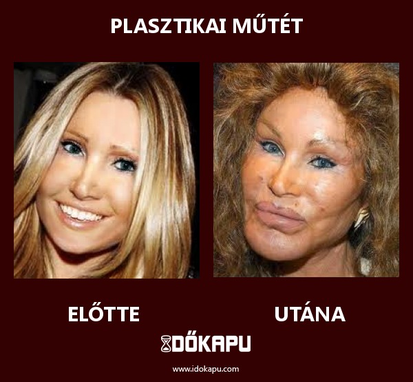 PLASZTIKAI MŰTÉT
 
 title=
